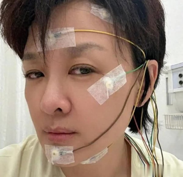 炒股配资交流 央视著名女主持连续25年失眠，全身插电极医生却查不出原因